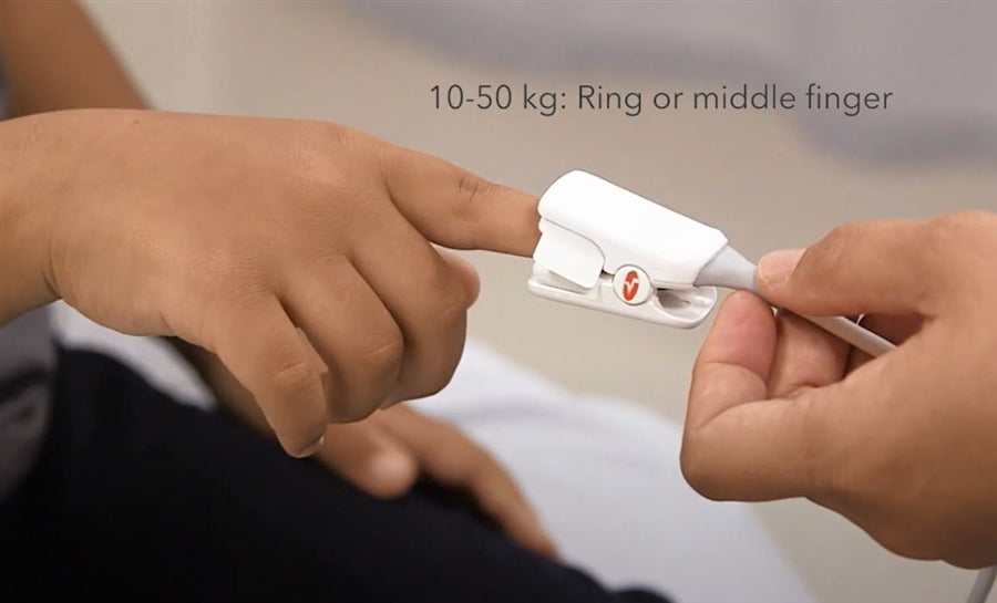 Masimo Rad-G Pulse Oximeter